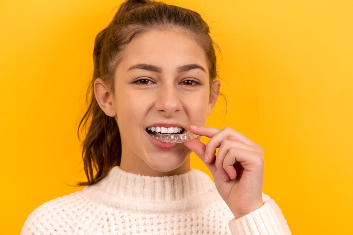Natural, confident smile after aligner treatment