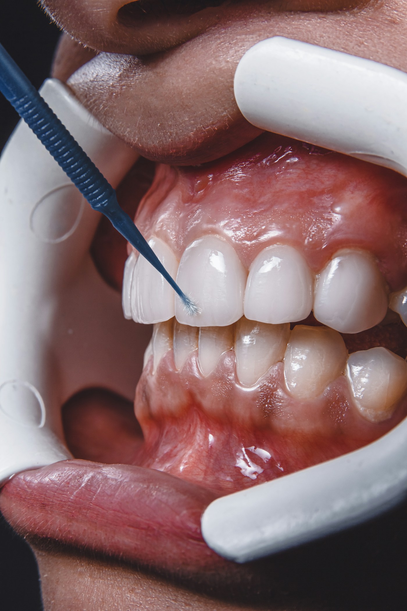 Comfortable, healthy oral environment