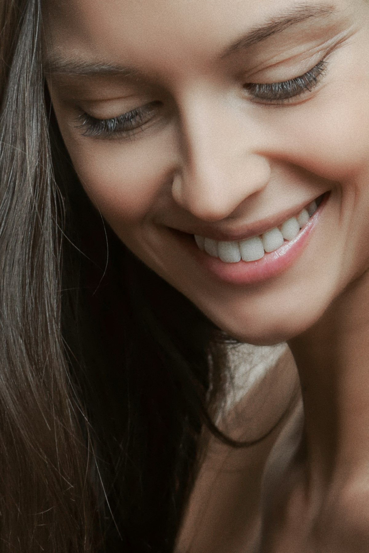 Natural smile after composite bonding treatment
